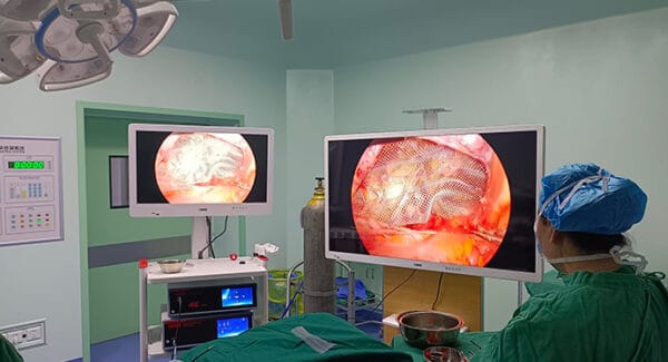 150 Watt Medical Surgical Light