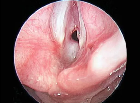 Endoscopy Diagnostic Integrated Portable Unit For ENT Otology HD 720P - Image 2