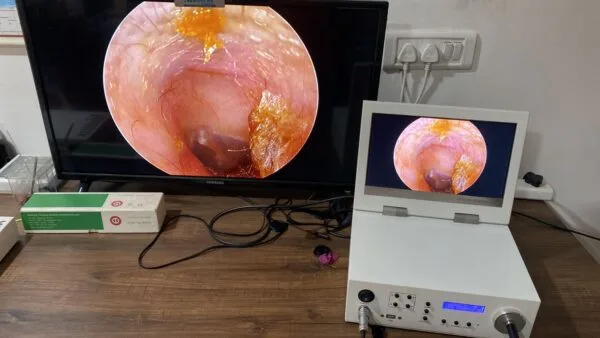 Endoscopy Diagnostic Integrated Portable Unit For ENT Otology HD 720P