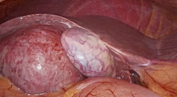 Medical Surgical Endoscopy Camera For Laparoscopy Hysteroscopy - Image 2