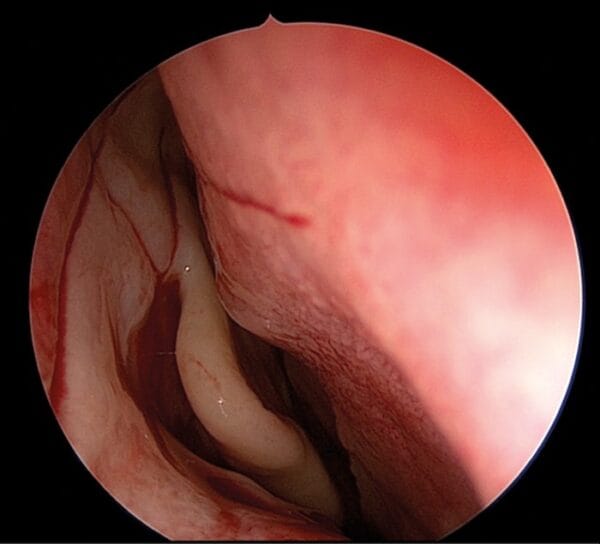 Medical Surgical Endoscopy Camera For ENT Neuro Otology