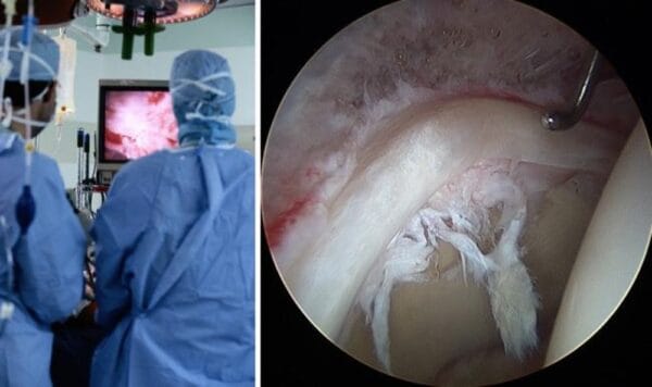 Medical Surgical Endoscopy Camera For Arthroscopy - Image 2