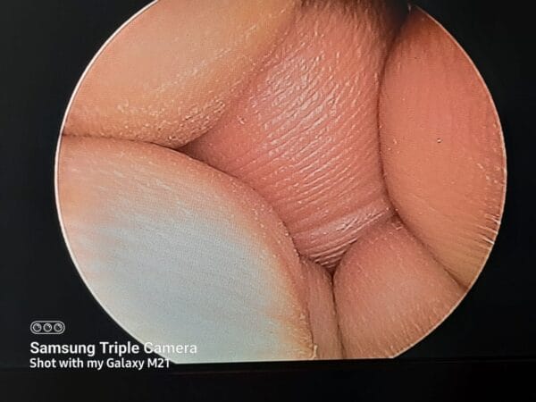 Endoscopy Diagnostic Integrated Portable Unit For Ent Otology Basic SD - Image 2