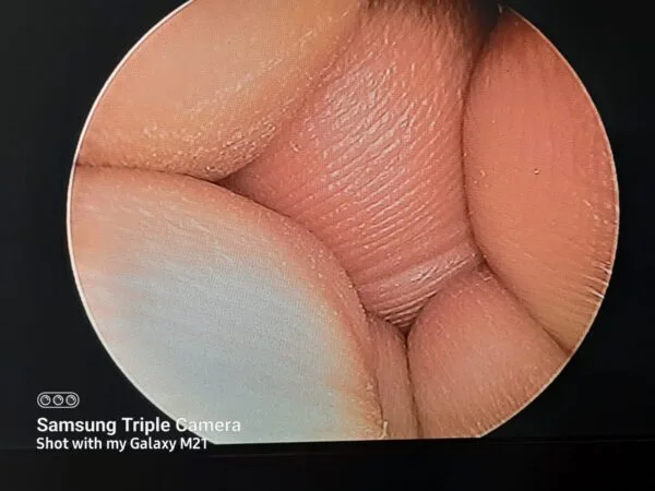 Endoscopy Diagnostic Integrated Portable Unit For ENT Otology HD 720P - Image 3