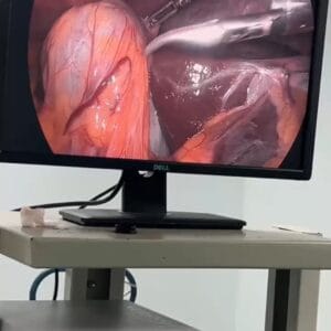 Medical Surgical Endoscopy Camera For Laparoscopy