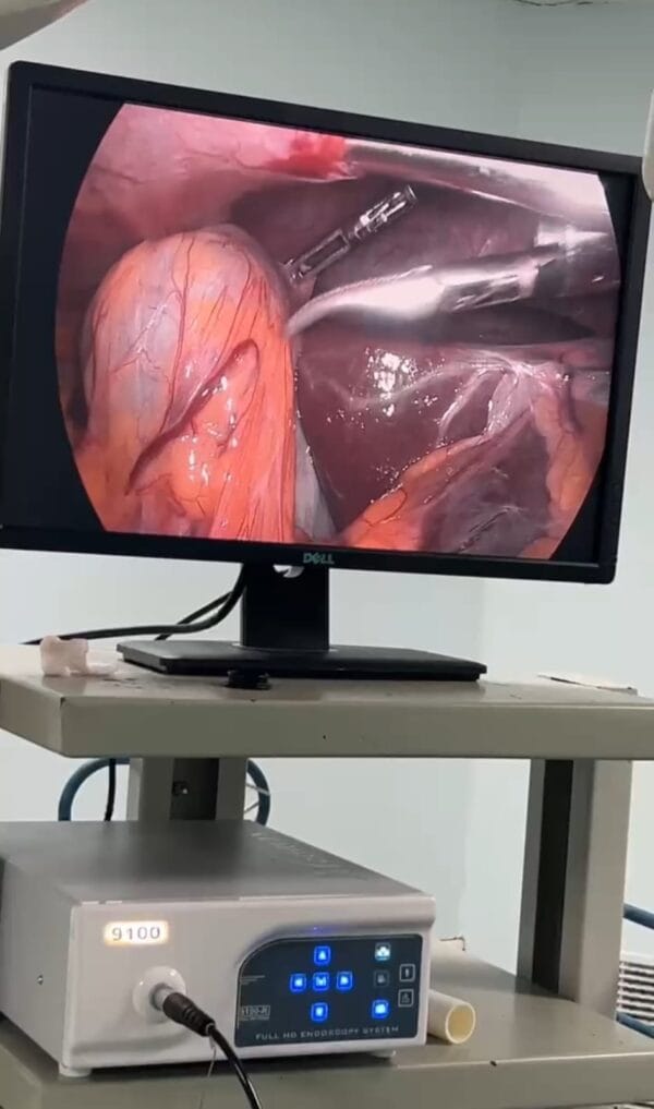 Medical Surgical Endoscopy Camera For Laparoscopy